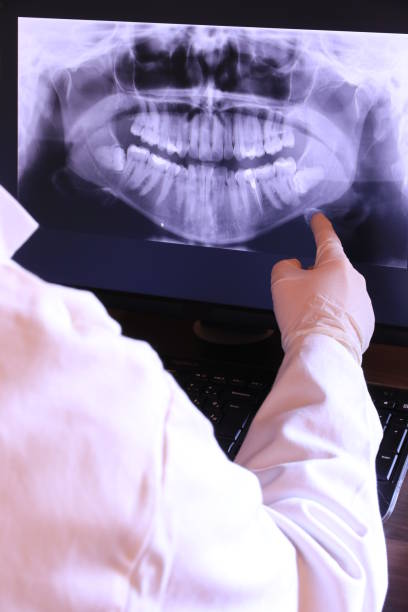 Best Emergency Tooth Extraction in Forest, OH