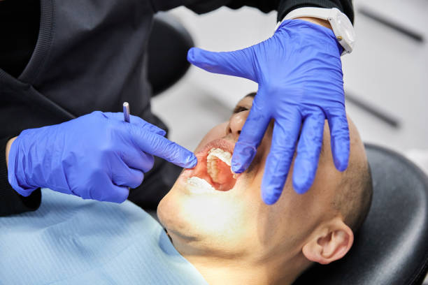 Best Emergency Broken Tooth Repair in Forest, OH