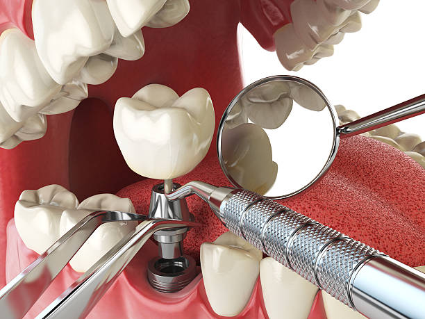 Best After-Hours Emergency Dentist in Forest, OH